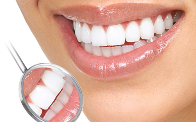 Diş Estetiğinde Kullanılan Teknikler