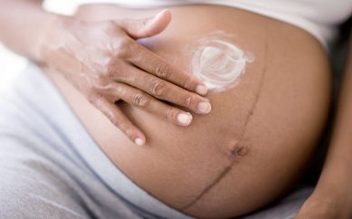 Hamileler İçin 7 Çatlak Kremi