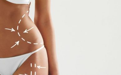 Vaser liposuction nedir?