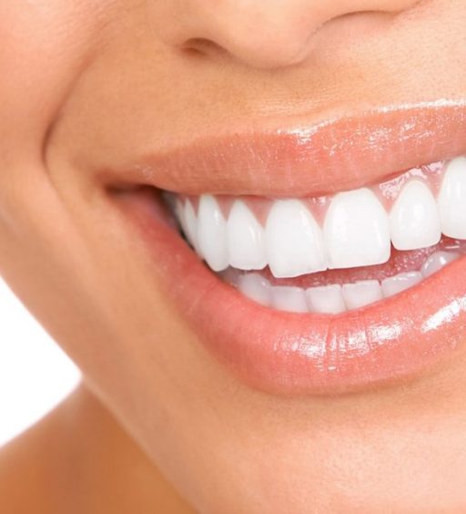Estetik diş hakkında