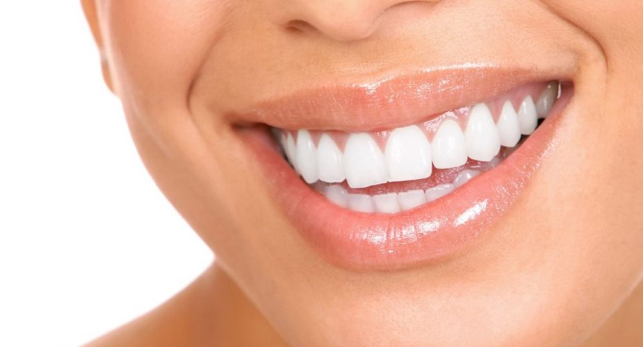 Estetik diş hakkında